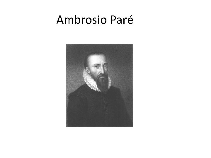 Ambrosio Paré 