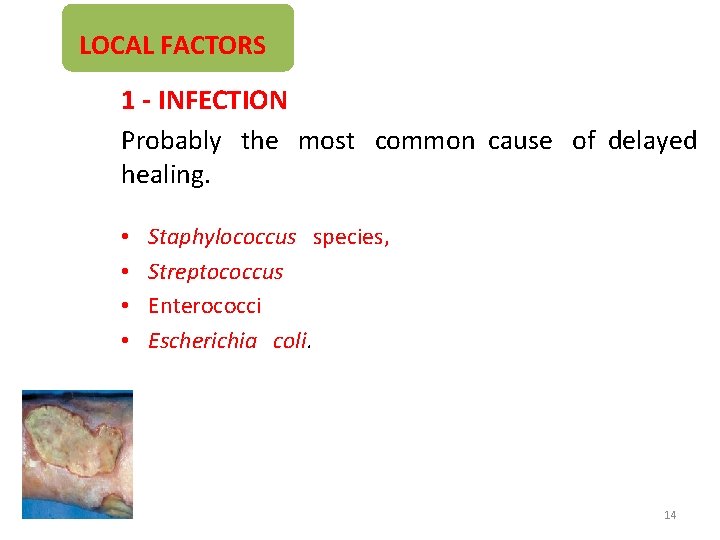 LOCAL FACTORS 1 - INFECTION Probably the most common cause of delayed healing. •