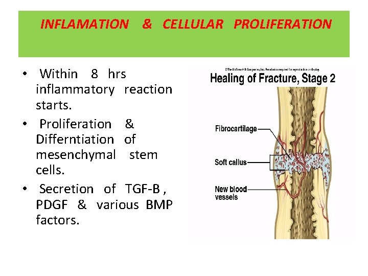 INFLAMATION & CELLULAR PROLIFERATION • Within 8 hrs inflammatory reaction starts. • Proliferation &