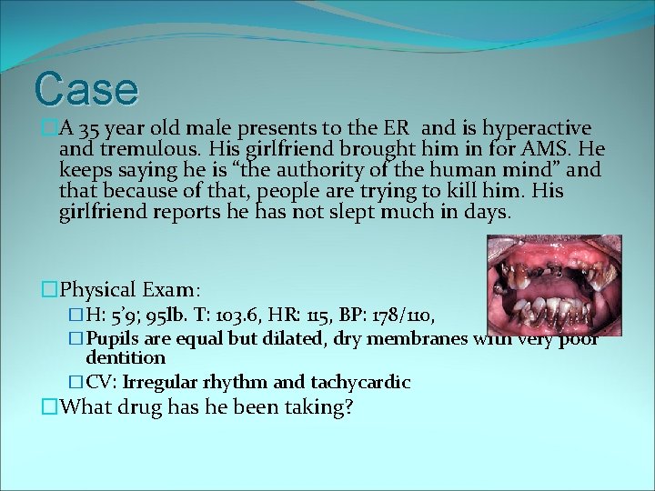 Case �A 35 year old male presents to the ER and is hyperactive and