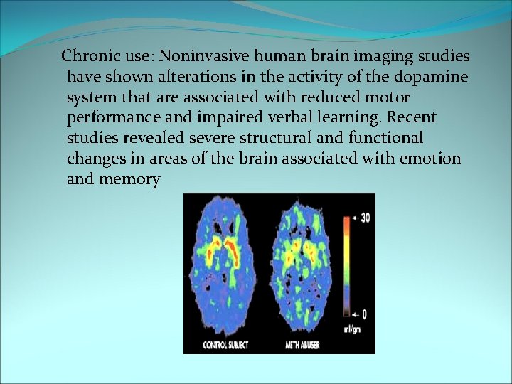 Chronic use: Noninvasive human brain imaging studies have shown alterations in the activity of