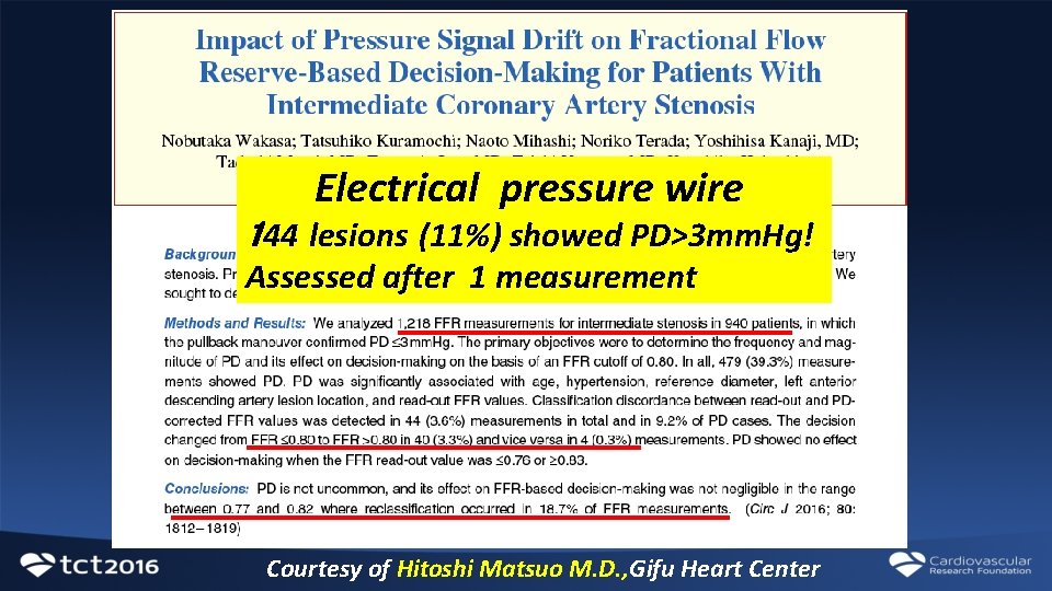 Electrical pressure wire 144 lesions (11%) showed PD>3 mm. Hg! Assessed after 1 measurement