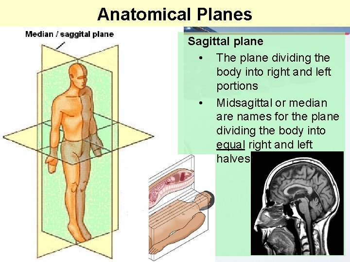 Anatomical Planes Sagittal plane • The plane dividing the body into right and left