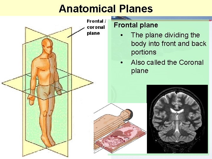 Anatomical Planes Frontal plane • The plane dividing the body into front and back