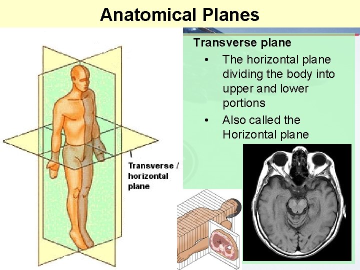 Anatomical Planes Transverse plane • The horizontal plane dividing the body into upper and