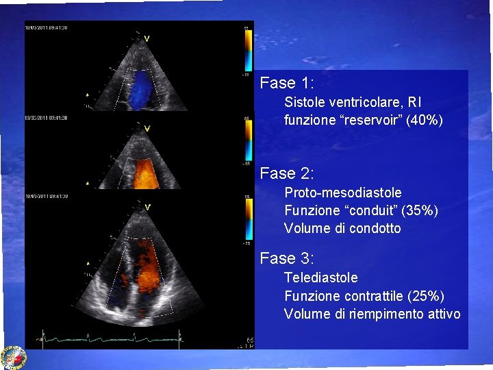 Fase 1: Sistole ventricolare, RI funzione “reservoir” (40%) Fase 2: Proto-mesodiastole Funzione “conduit” (35%)