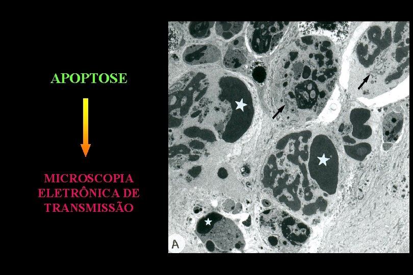 APOPTOSE MICROSCOPIA ELETRÔNICA DE TRANSMISSÃO 
