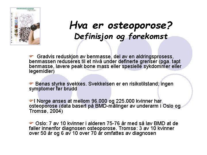 Hva er osteoporose? Definisjon og forekomst F Gradvis reduskjon av benmasse, del av en