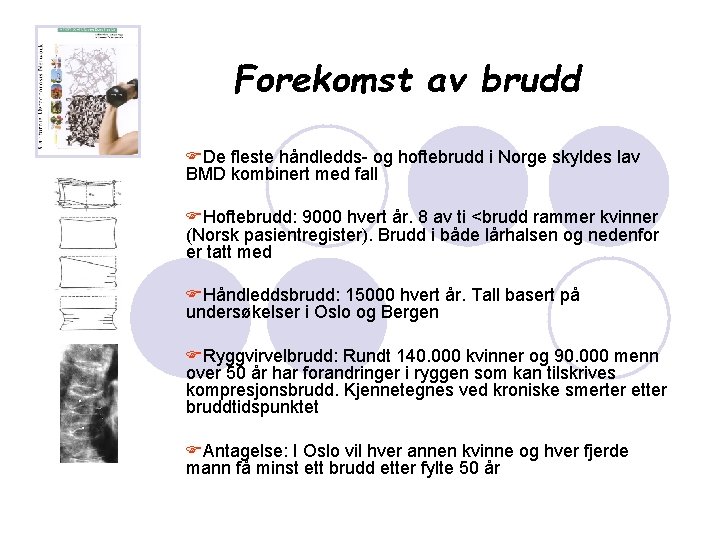 Forekomst av brudd FDe fleste håndledds- og hoftebrudd i Norge skyldes lav BMD kombinert