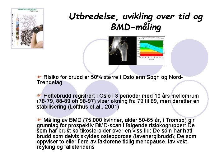 Utbredelse, uvikling over tid og BMD-måling F Risiko for brudd er 50% større i