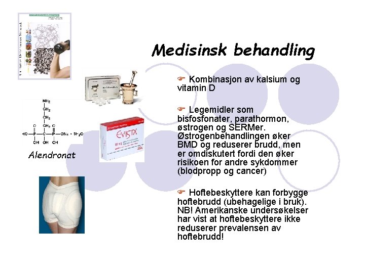 Medisinsk behandling F Kombinasjon av kalsium og vitamin D Alendronat F Legemidler som bisfosfonater,