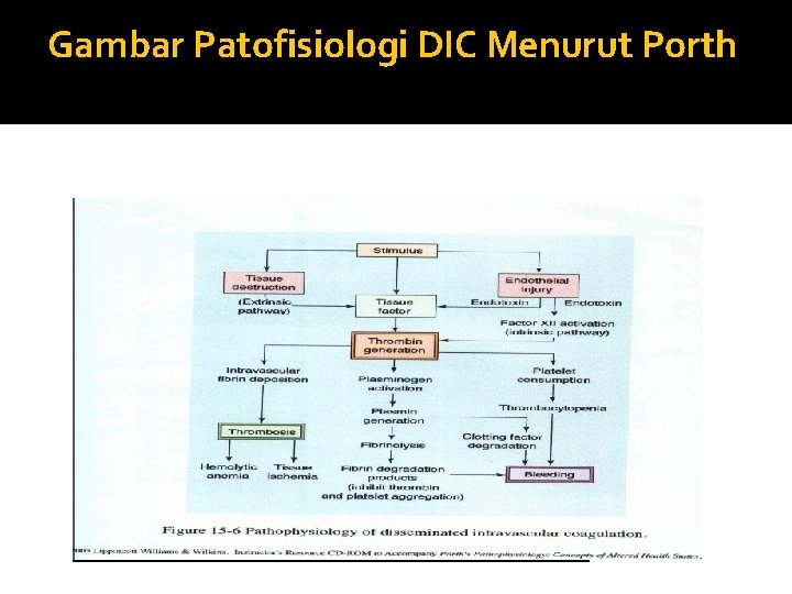 Gambar Patofisiologi DIC Menurut Porth 