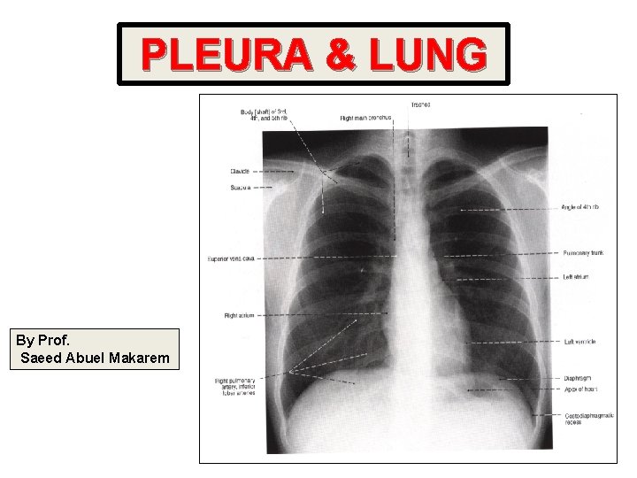 PLEURA & LUNG By Prof. Saeed Abuel Makarem 