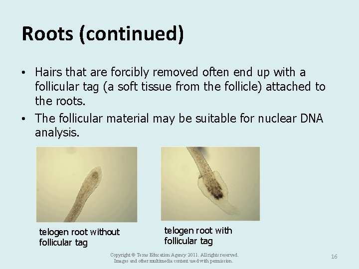 Roots (continued) • Hairs that are forcibly removed often end up with a follicular