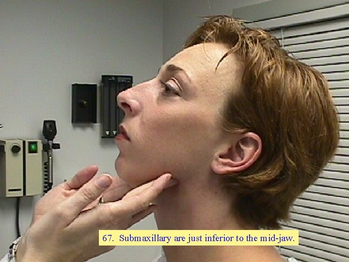 67. Submaxillary are just inferior to the mid-jaw. 