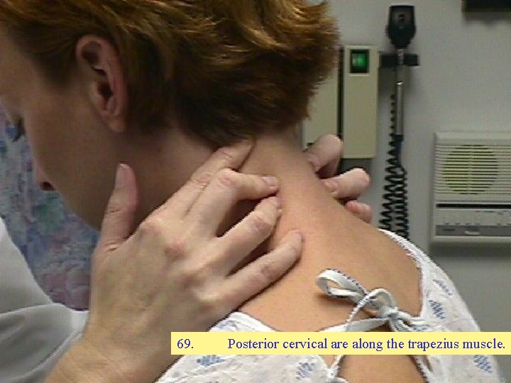 69. Posterior cervical are along the trapezius muscle. 