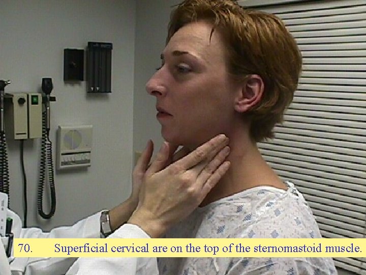 70. Superficial cervical are on the top of the sternomastoid muscle. 