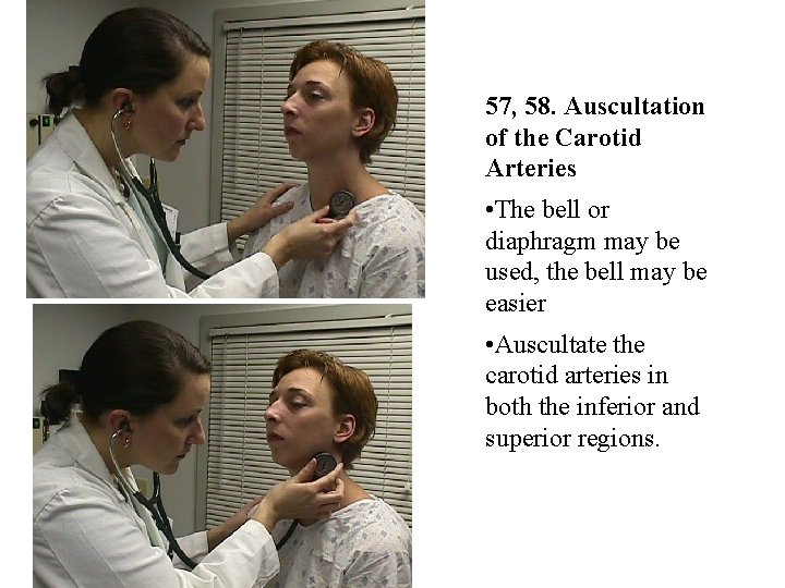 57, 58. Auscultation of the Carotid Arteries • The bell or diaphragm may be