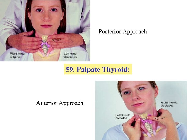 Posterior Approach 59. Palpate Thyroid: Anterior Approach 