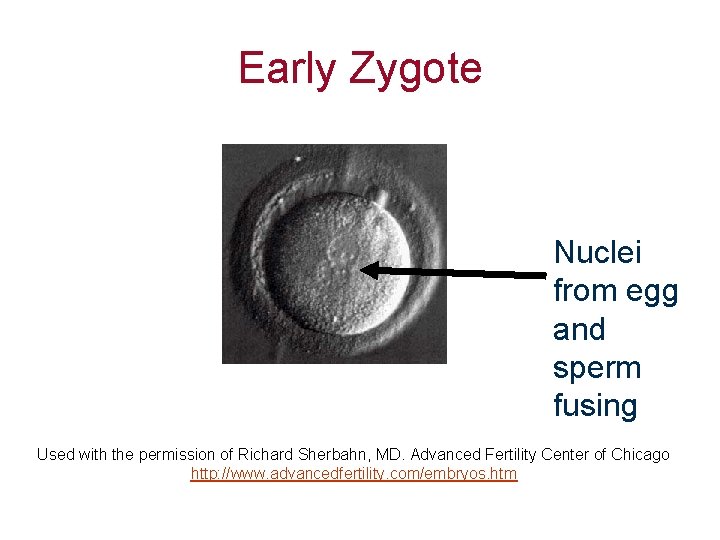 Early Zygote Nuclei from egg and sperm fusing Used with the permission of Richard