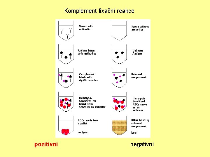 Komplement fixační reakce pozitivní negativní 