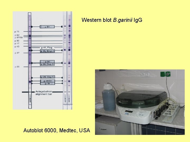 Western blot B. garinii Ig. G Autoblot 6000, Medtec, USA 