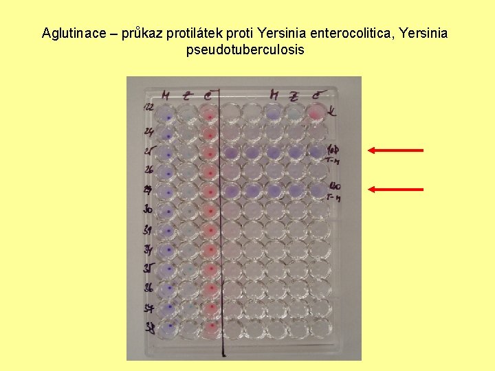 Aglutinace – průkaz protilátek proti Yersinia enterocolitica, Yersinia pseudotuberculosis 