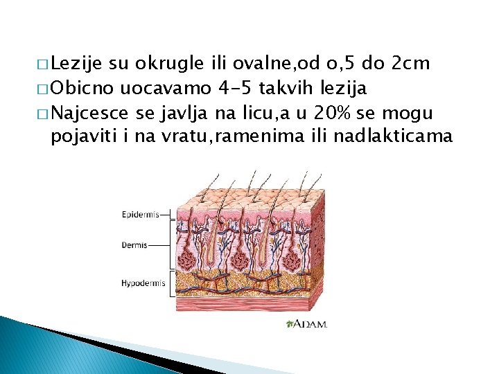 � Lezije su okrugle ili ovalne, od o, 5 do 2 cm � Obicno