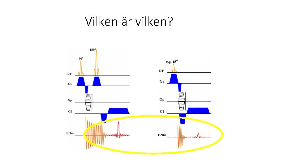 Vilken är vilken? 