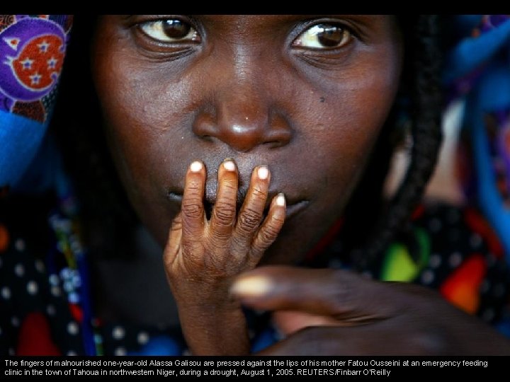 The fingers of malnourished one-year-old Alassa Galisou are pressed against the lips of his