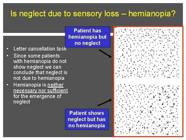 Is neglect due to sensory loss – hemianopia? • Letter cancellation task • Since