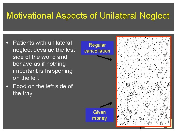 Motivational Aspects of Unilateral Neglect • Patients with unilateral neglect devalue the lest side