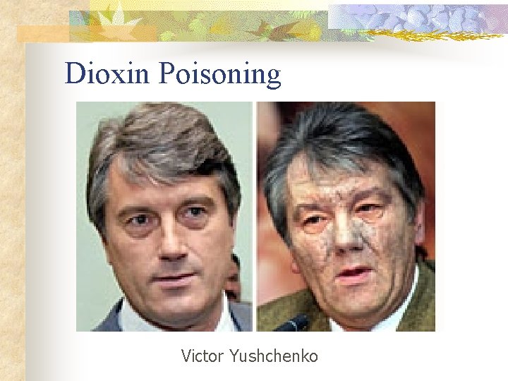 Dioxin Poisoning Victor Yushchenko 