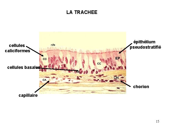 LA TRACHEE cellules caliciformes épithélium pseudostratifié cellules basales chorion capillaire 15 LA TRACHEE cellules caliciformes épithélium pseudostratifié cellules basales chorion capillaire 15