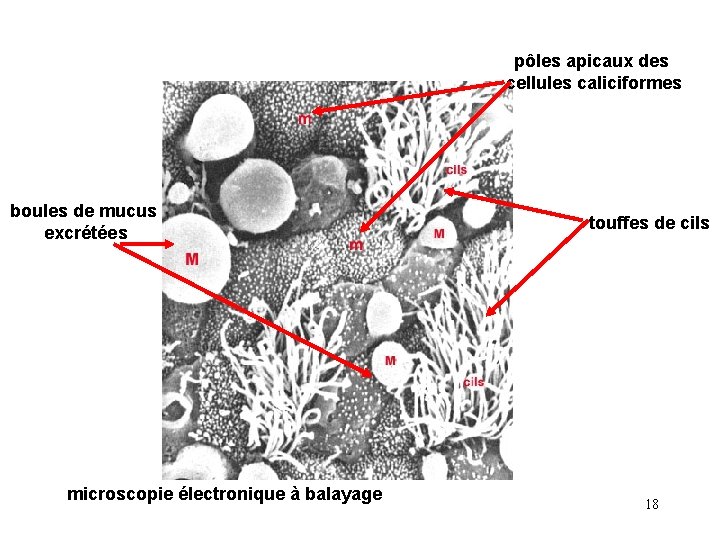 pôles apicaux des cellules caliciformes boules de mucus excrétées microscopie électronique à balayage touffes pôles apicaux des cellules caliciformes boules de mucus excrétées microscopie électronique à balayage touffes