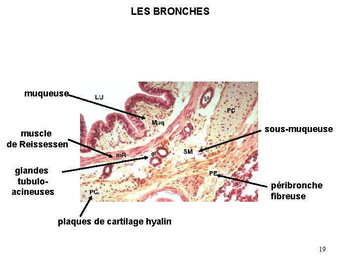 LES BRONCHES muqueuse muscle de Reissessen glandes tubuloacineuses sous-muqueuse péribronche fibreuse plaques de cartilage LES BRONCHES muqueuse muscle de Reissessen glandes tubuloacineuses sous-muqueuse péribronche fibreuse plaques de cartilage