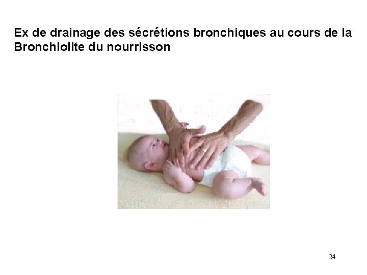 Ex de drainage des sécrétions bronchiques au cours de la Bronchiolite du nourrisson 24 Ex de drainage des sécrétions bronchiques au cours de la Bronchiolite du nourrisson 24