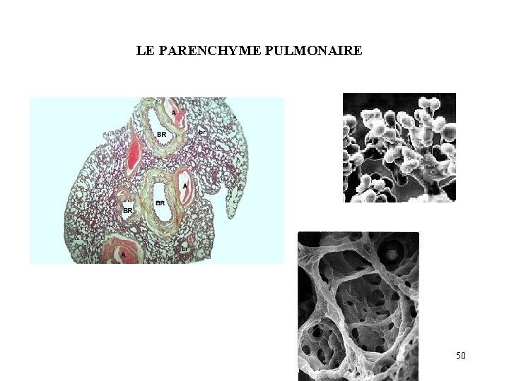 LE PARENCHYME PULMONAIRE 50 LE PARENCHYME PULMONAIRE 50