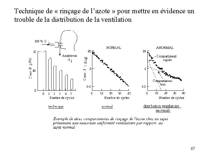 Technique de « rinçage de l’azote » pour mettre en évidence un trouble de Technique de « rinçage de l’azote » pour mettre en évidence un trouble de