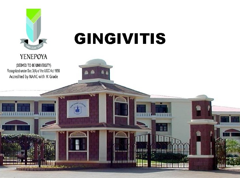 GINGIVITIS GINGIVITIS