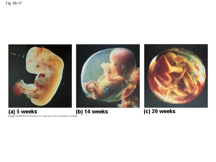 Fig. 46 -17 (a) 5 weeks (b) 14 weeks (c) 20 weeks 