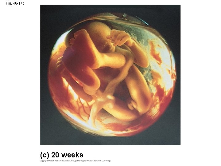 Fig. 46 -17 c (c) 20 weeks 