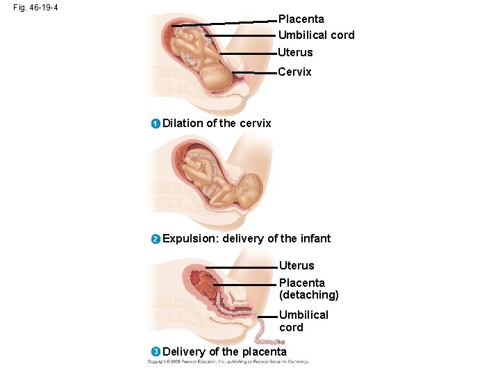 Fig. 46 -19 -4 Placenta Umbilical cord Uterus Cervix 1 Dilation of the cervix