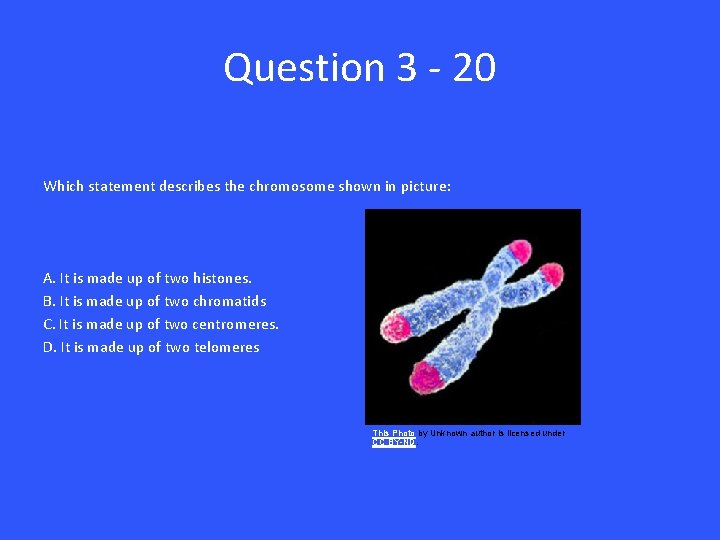 Question 3 - 20 Which statement describes the chromosome shown in picture: A. It