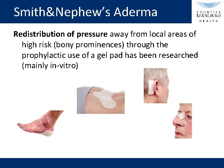 Smith&Nephew’s Aderma Redistribution of pressure away from local areas of high risk (bony prominences)