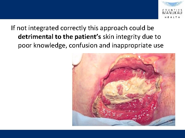 If not integrated correctly this approach could be detrimental to the patient’s skin integrity