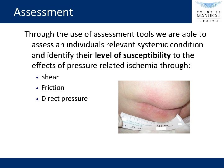 Assessment Through the use of assessment tools we are able to assess an individuals