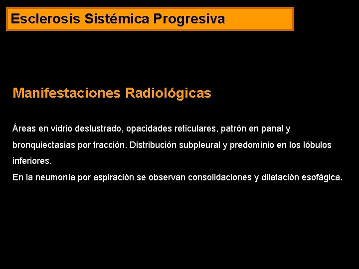 Esclerosis Sistémica Progresiva Manifestaciones Radiológicas Áreas en vidrio deslustrado, opacidades reticulares, patrón en panal