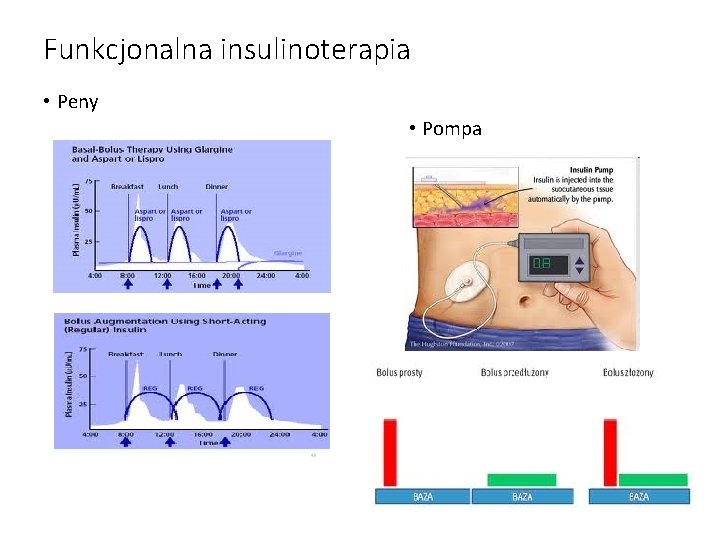 Funkcjonalna insulinoterapia • Peny • Pompa 7 
