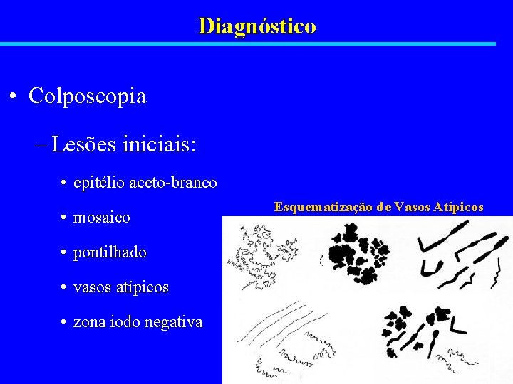 Diagnóstico • Colposcopia – Lesões iniciais: • epitélio aceto-branco • mosaico • pontilhado •